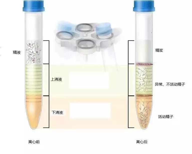 做试管之前要检查精子碎片吗,做试管会洗掉精子碎片吗