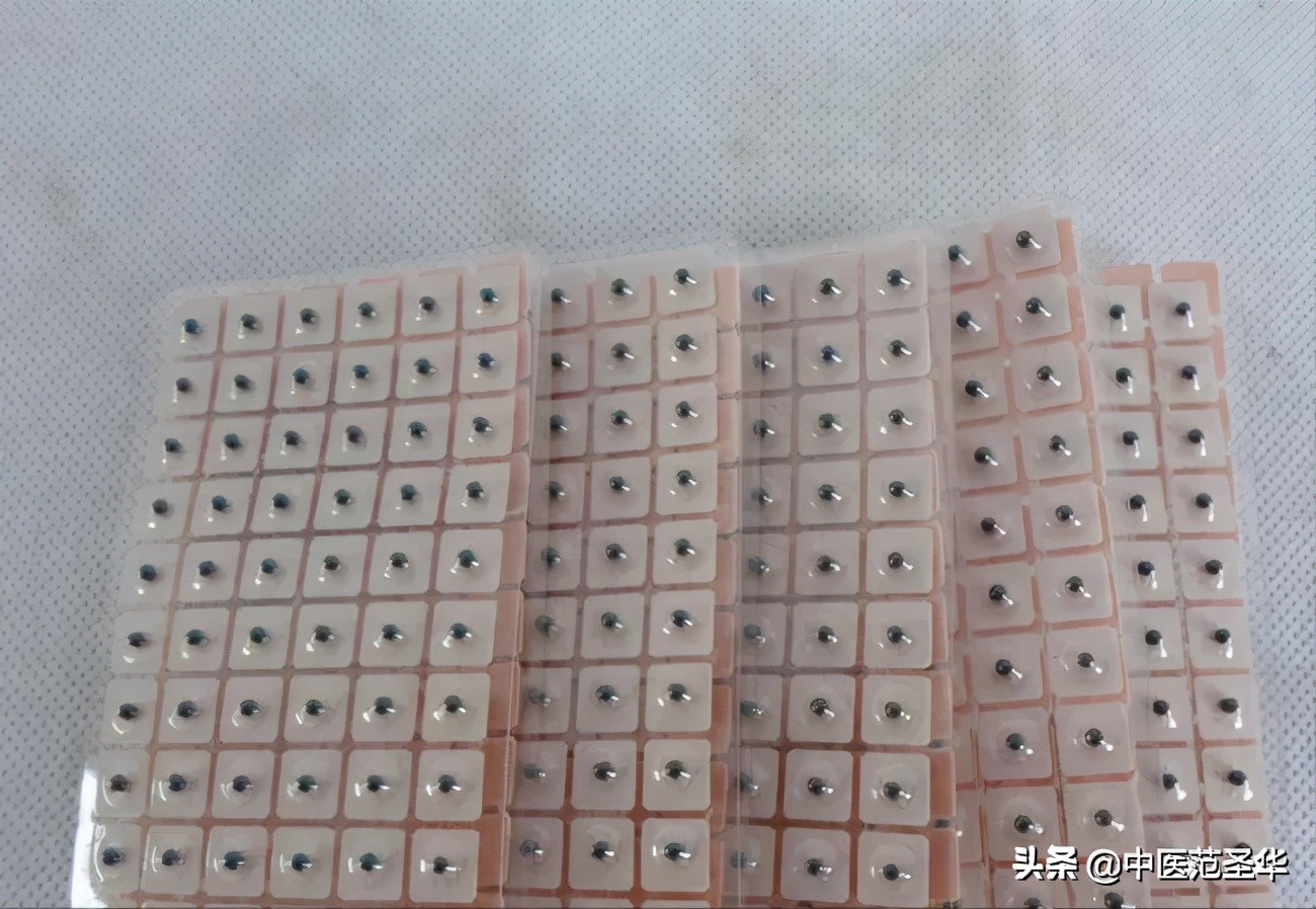 治疗近视眼应该注意什么,预防治疗近视眼最佳的医院