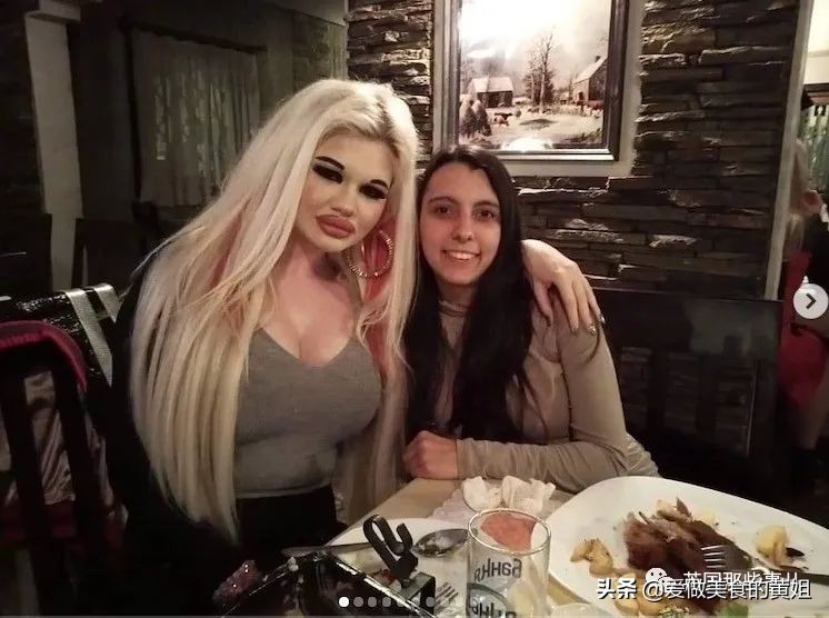 20次整容成功的女人,22岁女人做20次丰唇手术