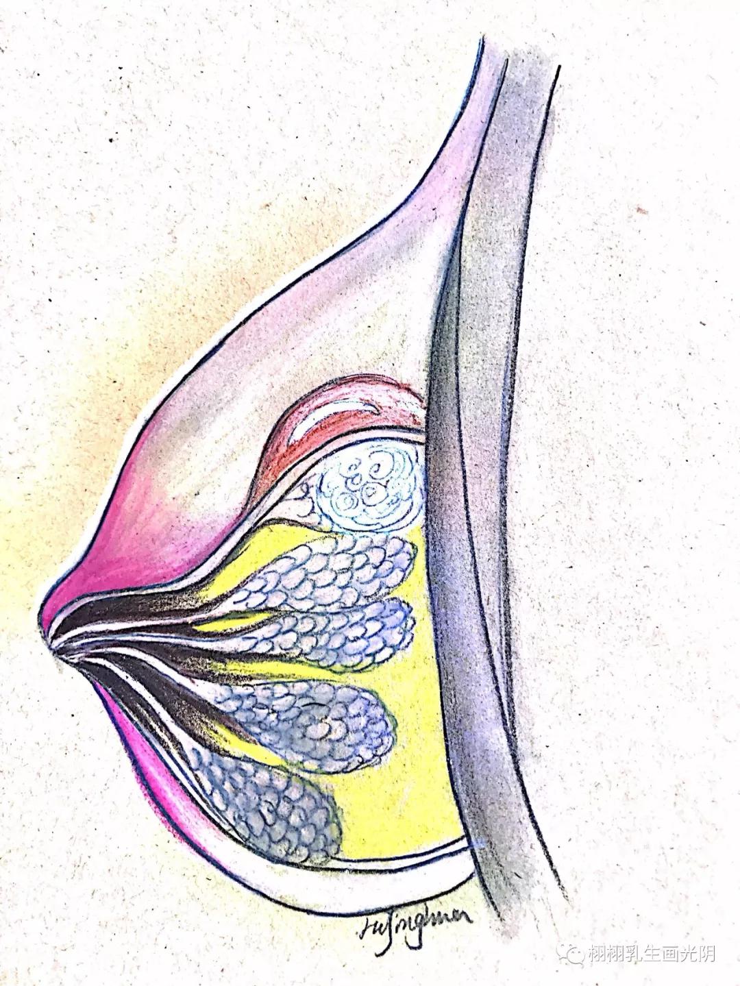 良性乳腺肿瘤要切除吗,乳腺良性病变可能性大