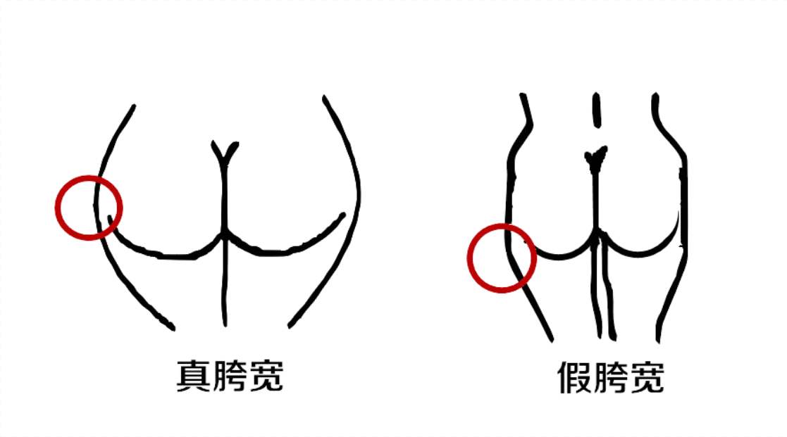 假胯宽翘臀矫正的正确方法,臀腿假胯宽训练