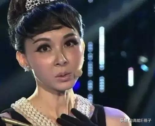 微整形需要多久,微整形后多久恢复正常