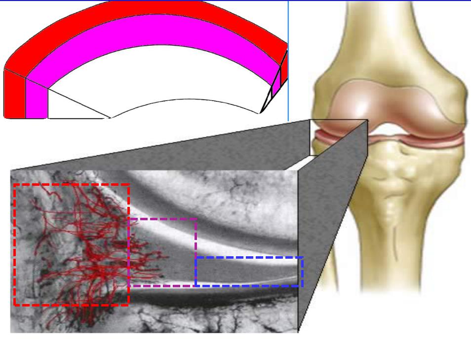 半月板损伤康复训练,半月板损伤膝盖疼的最好治疗方法