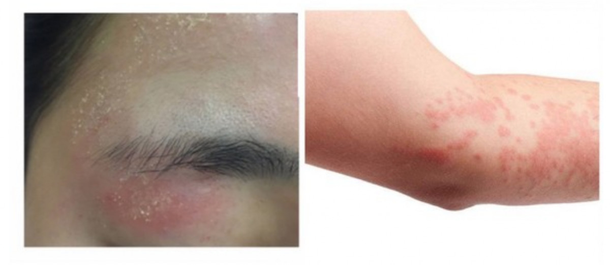 敏感肌肤护肤禁忌,敏感肌肤护肤正确方法