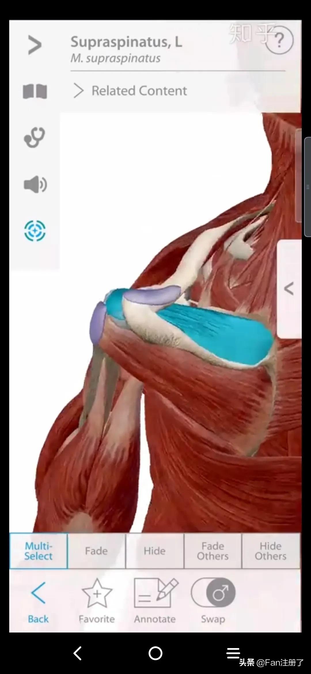 鑲╁嘲涓嬫粦鍥婄値鐥呭洜,鑲╁嘲婊戝泭鐐庝綅缃浘