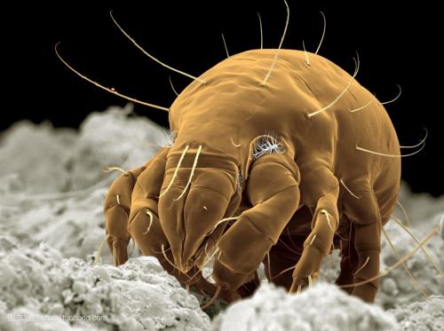 孕妇得了螨虫病会对宝宝影响吗,螨虫包对孕妇有害吗