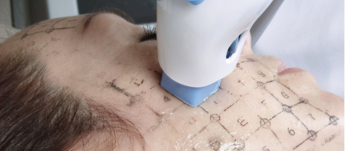 面部松弛下垂的最好解决办法,面部松弛下垂的最快恢复办法