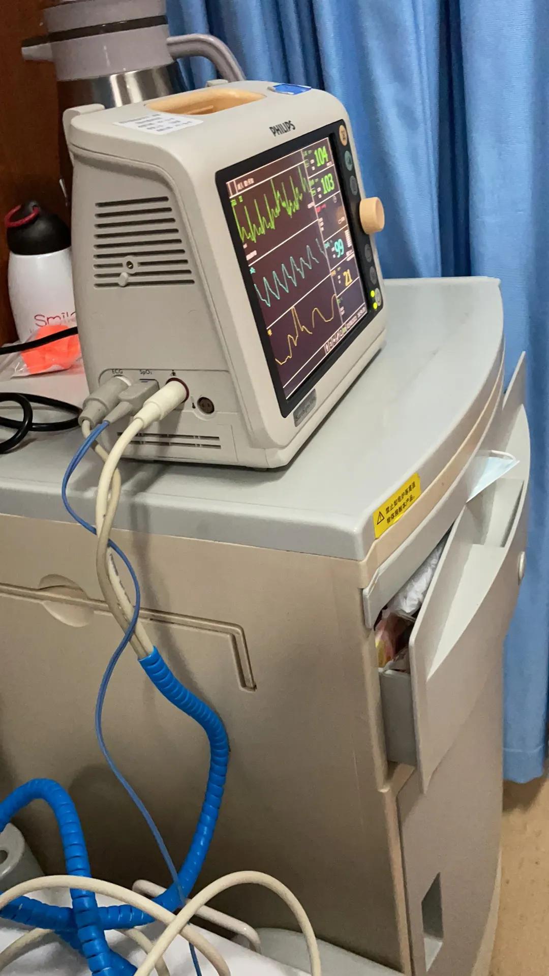 狼疮治疗记录,狼疮肾炎10年了