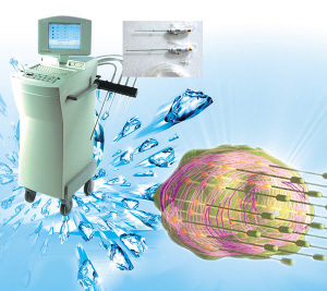 最有效祛痘疤方法,祛痘疤最有效的方法学生