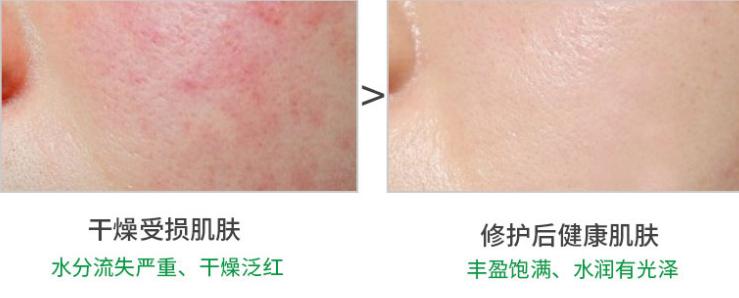 换季护肤面霜大牌,换季护肤大作战视频