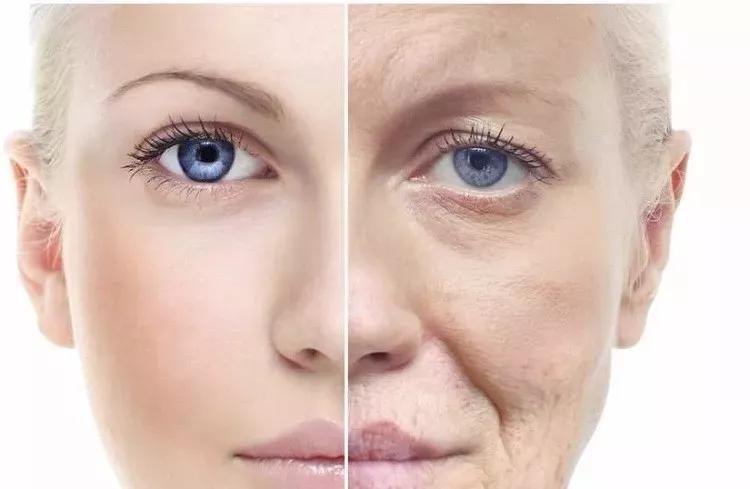 抬头纹鱼尾纹法令纹哪个更显老,抬头纹鱼尾纹法令纹颈纹一样没少