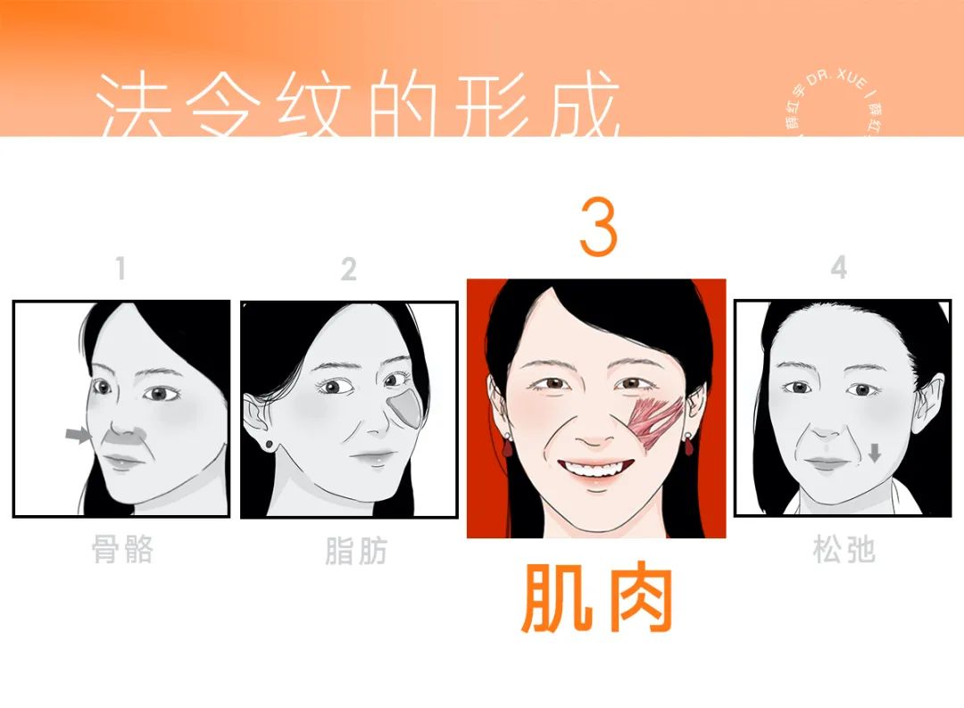 法令纹怎么改善脸部衰老,改善法令纹按摩手法视频