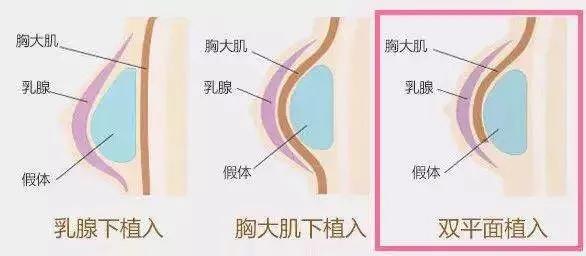 女生运动瘦不下来,女人运动瘦不下来怎么回事