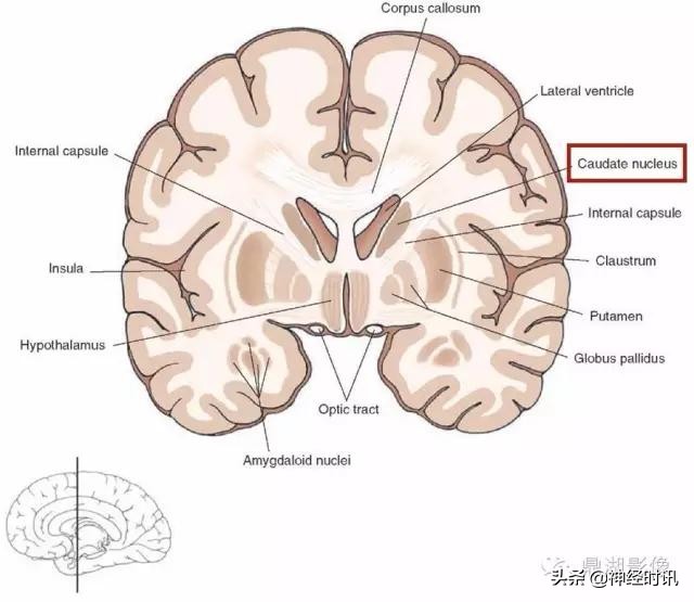 基底节ct解剖示意图,影像解剖图谱怎么用