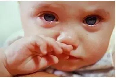 宝宝不会擤鼻涕,宝宝不会咳痰擤鼻涕能擤出来吗