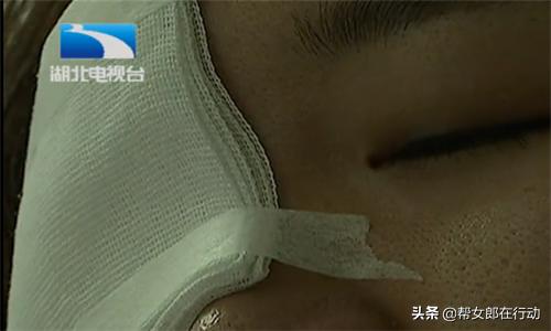 日本网红眼药水,日本网红眼药水青光眼