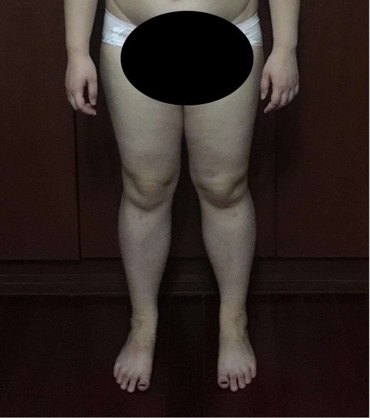 q角评估,q角指标详解图解