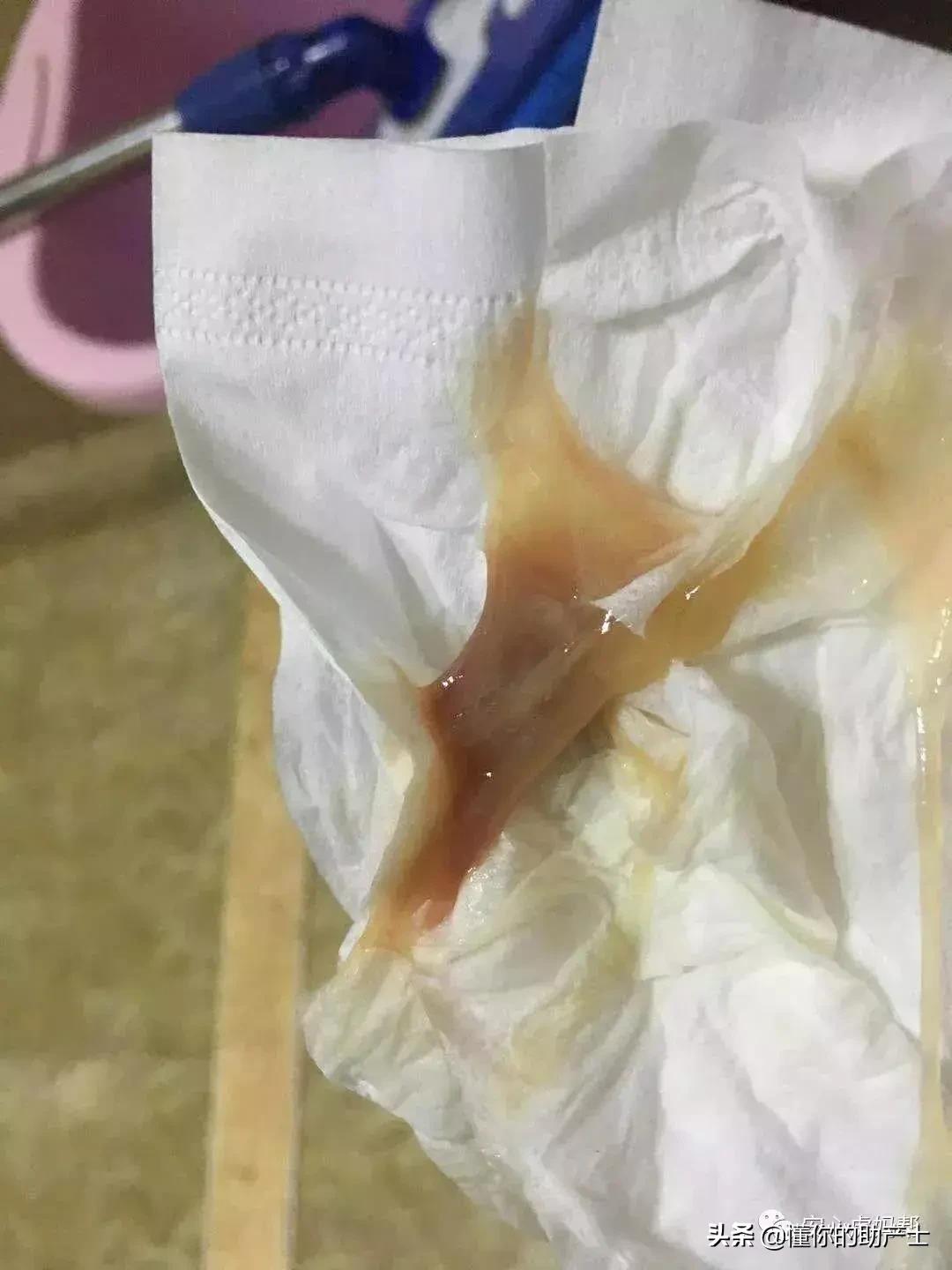 在孕期注意什么,孕期在家需要注意什么