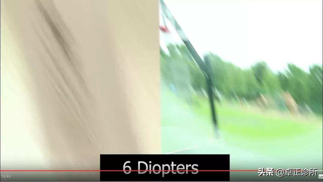 怎么按摩眼睛改善散光,怎么锻炼眼睛能改善散光