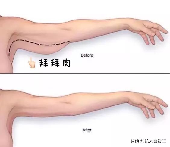 穿吊带瘦手臂的方法,七分袖瘦手臂最快的方法