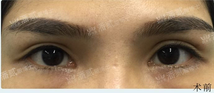 双眼皮凹陷眉毛怎么设计好看,凹眼窝适合什么眉型