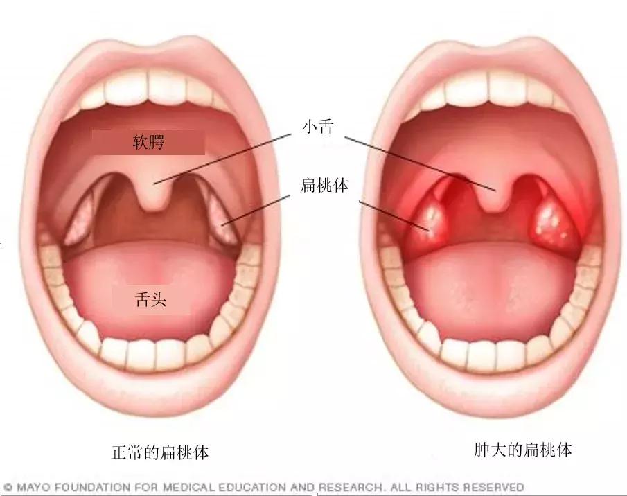 孩子有个小毛病是高智商表现,小孩从小智商发育不正常是什么病