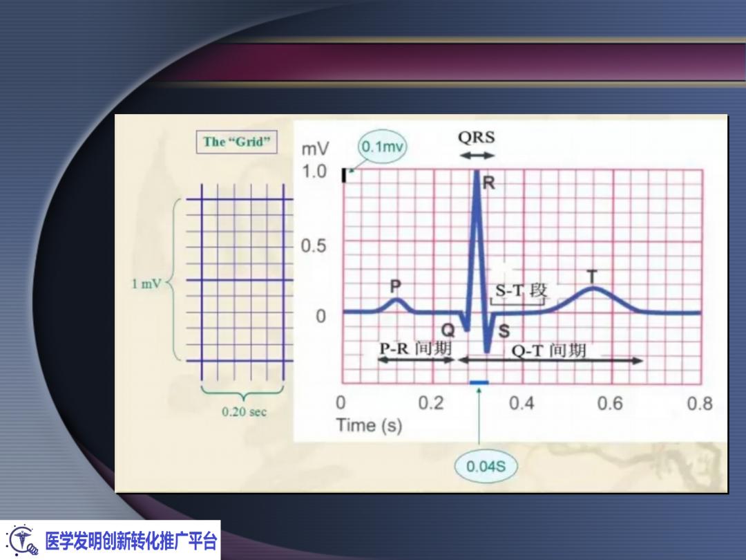麻醉手术常见心律失常处理,麻醉引起心脏骤停原因