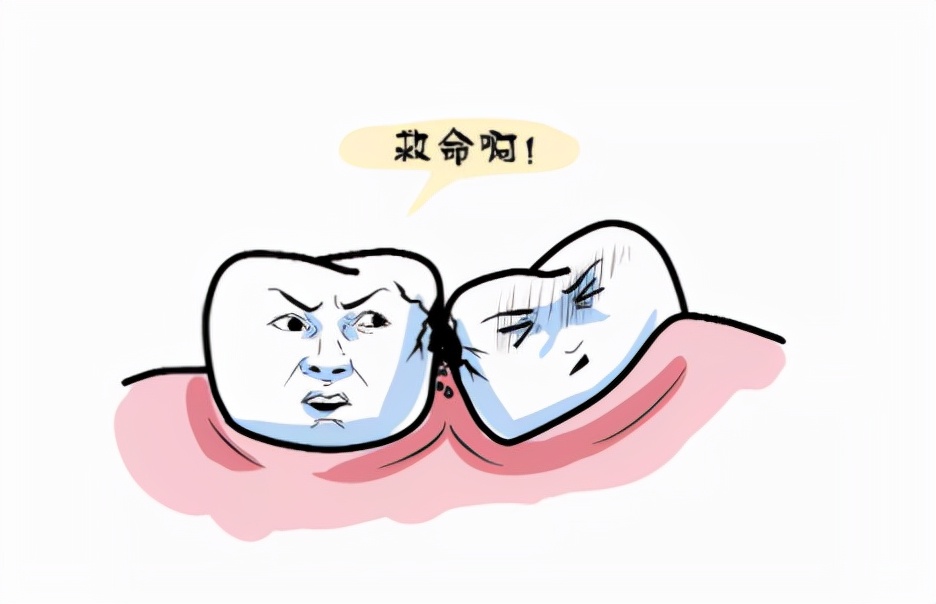 女子智齿反复发炎脸颊,智齿反复发炎脸上烂掉了