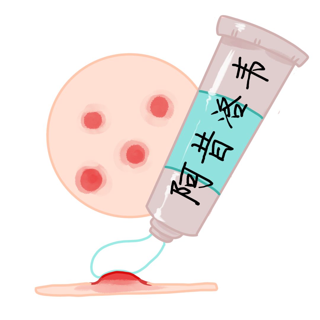 腰缠万贯到底是什么,腰缠万贯是什么病