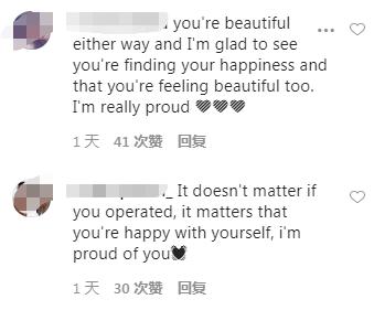 韩国明星男整容对比,韩国男明星整容疑似失败