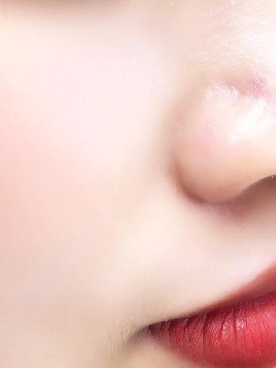 脸蛋两侧长了许多黑头是什么原因,脸蛋年轻貌美