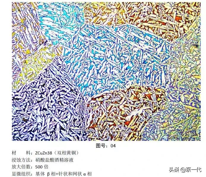 马氏体、奥氏体、珠光体，20种材料彩色金相，带你轻松识别