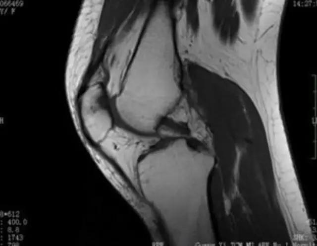 mri临床医师必读电子书,临床医生如何读mri
