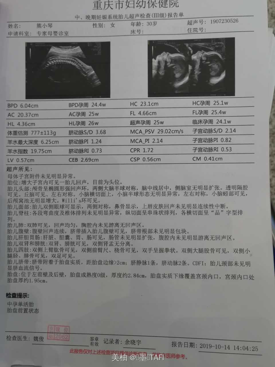 切口妊娠的治疗方法,切口妊娠人流危险吗