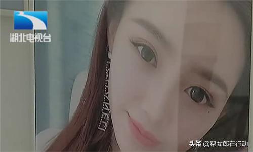 女子隆鼻失败要求免费修复被拒绝,女子隆鼻手术后感染