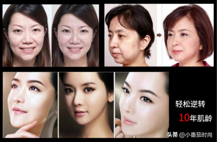 热拉提面部美容仪,热波拉提美容仪