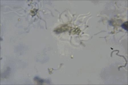 马桶顽固垢能用火烧吗,马桶陈年硬垢堵厕所