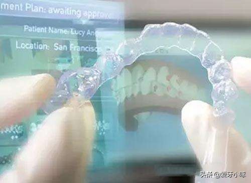 时代天使隐形矫正多少钱,时代天使隐形矫正收费标准