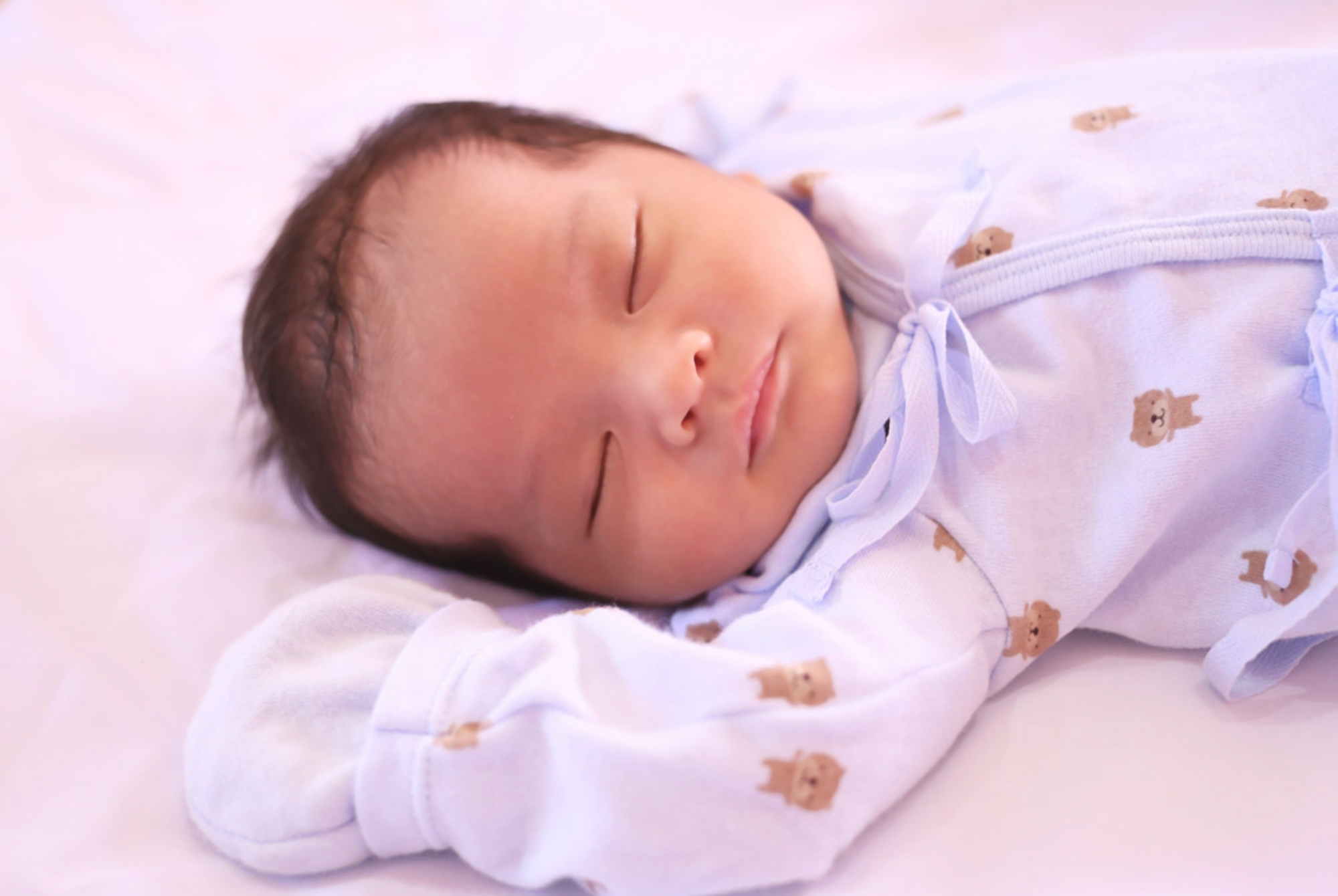 宝宝头上斑秃是什么原因造成的,是不是每个宝宝都秃顶