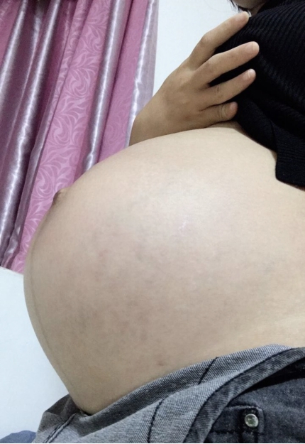 怀孕了有必要保胎吗,怀孕有必要那么娇气嘛