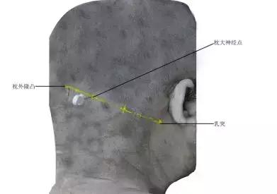 颈源性头痛中医治疗,颈源性头痛中药处方