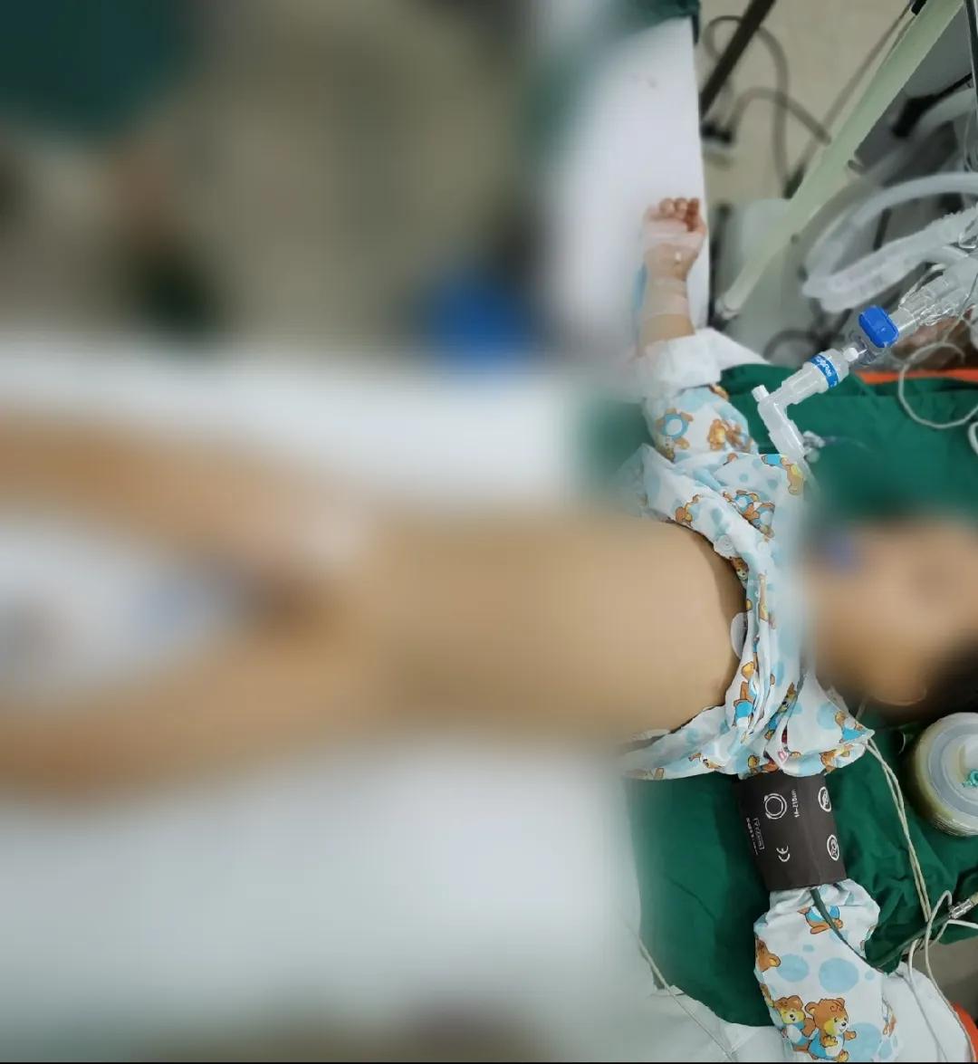 4岁小孩切除150厘米小肠,儿童小肠切除25cm多久能恢复