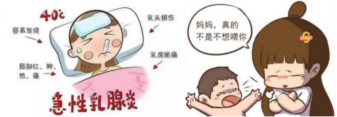 体检乳腺里有好多小疙瘩,体检时发现乳房有结节