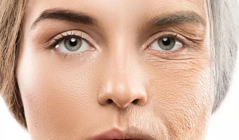 动态纹会变成静态纹,静态纹和动态纹哪个容易去掉