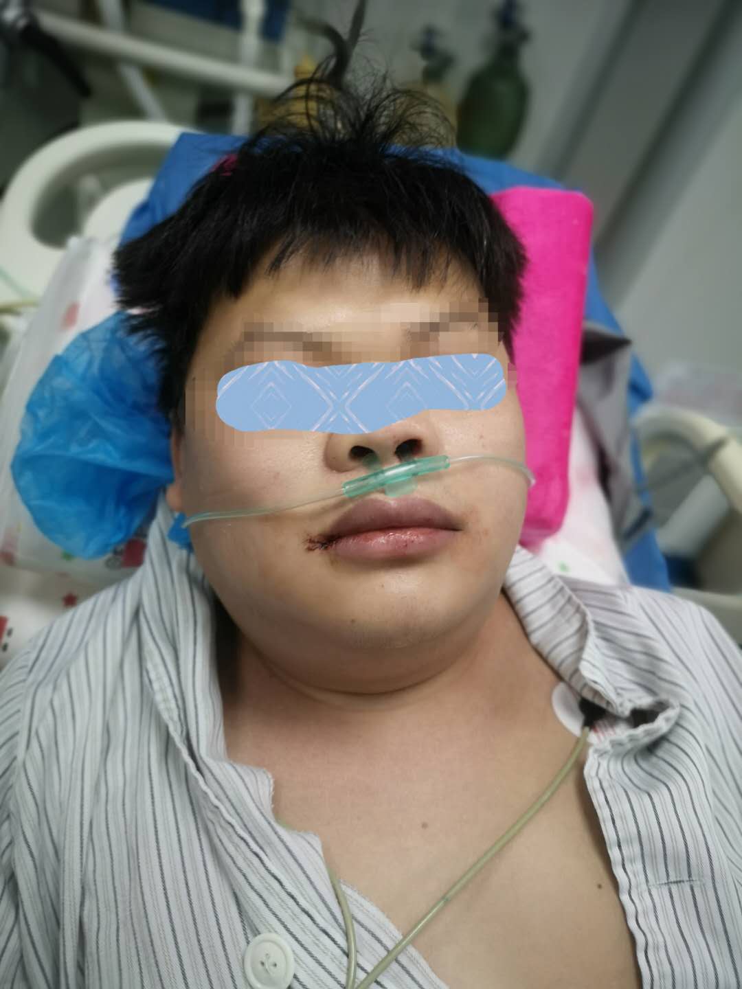 26岁小伙腰腿痛,男子51岁两胯痛是怎么回事
