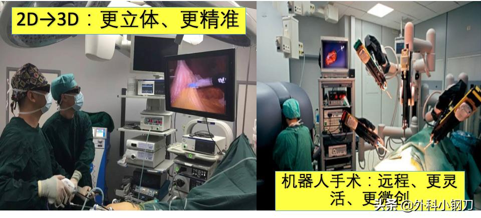 鍖荤敓鍓叉帀澶ц偁,鑲涢棬鍒囬櫎鍚庣画娌荤枟