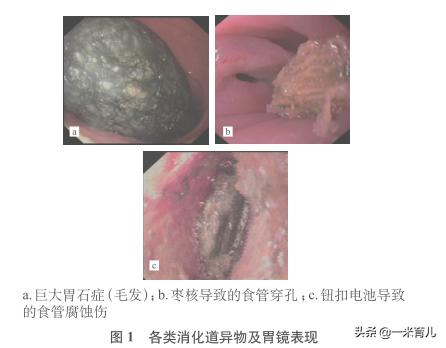 儿童小异物,宝宝吞食异物急救