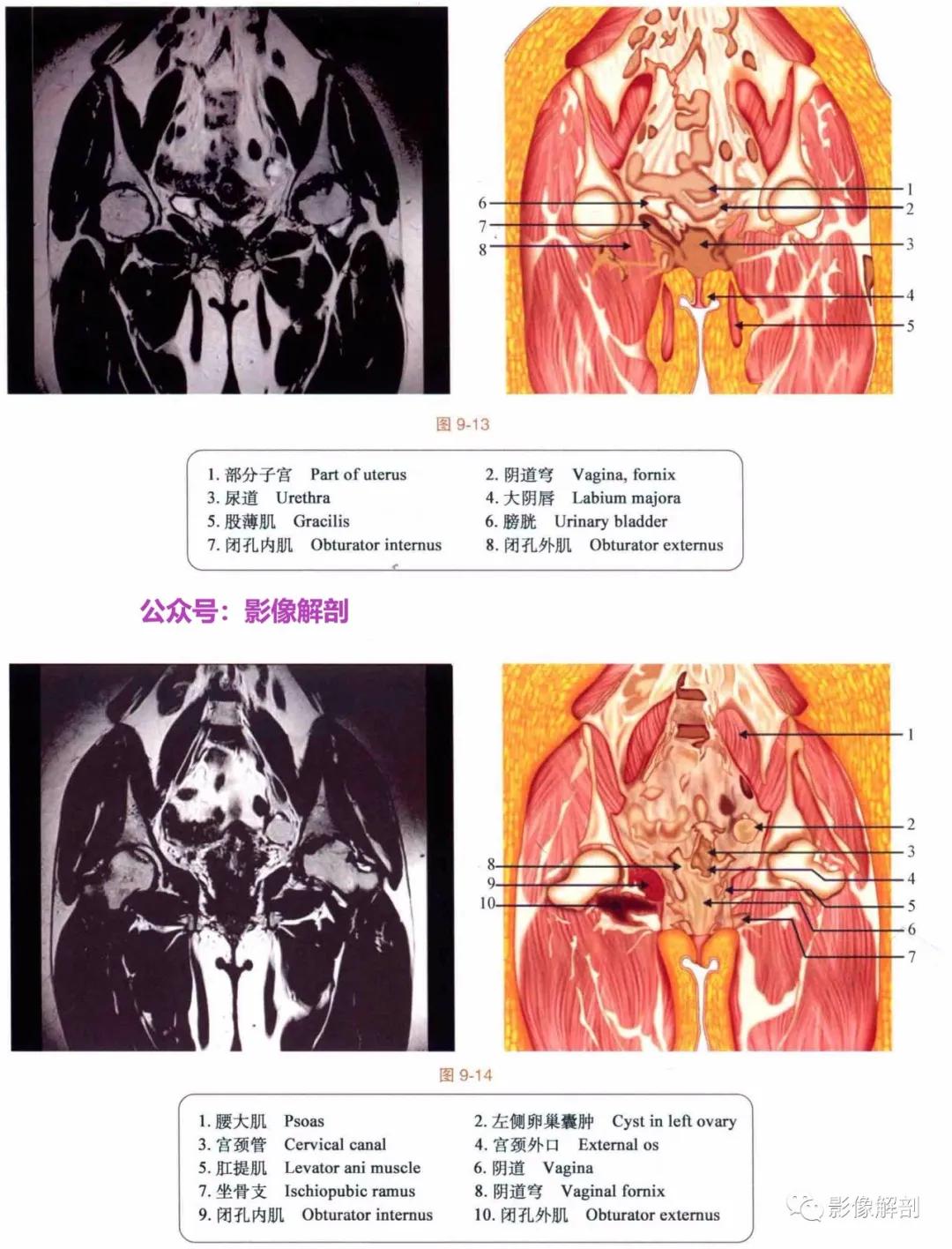 女性盆腔矢状位断层解剖,男性盆腔磁共振断层图谱