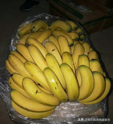 南京30岁女子查出银屑病，因为家里的这些香蕉，还是丈夫买的