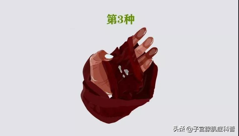 女士裤头有白带什么原因,女性裤头上带有褐色血渍什么原因